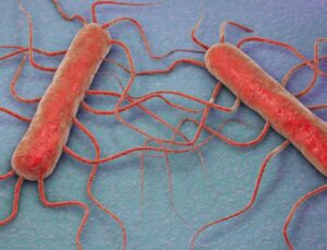 ABD’de listeria alarmı: Bir bebek öldü, 9 kişi hastaneye kaldırıldı