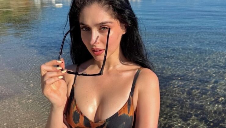 Cemre Baysel bir kere daha ameliyat olacak